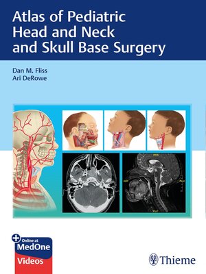cover image of Atlas of Pediatric Head and Neck and Skull Base Surgery